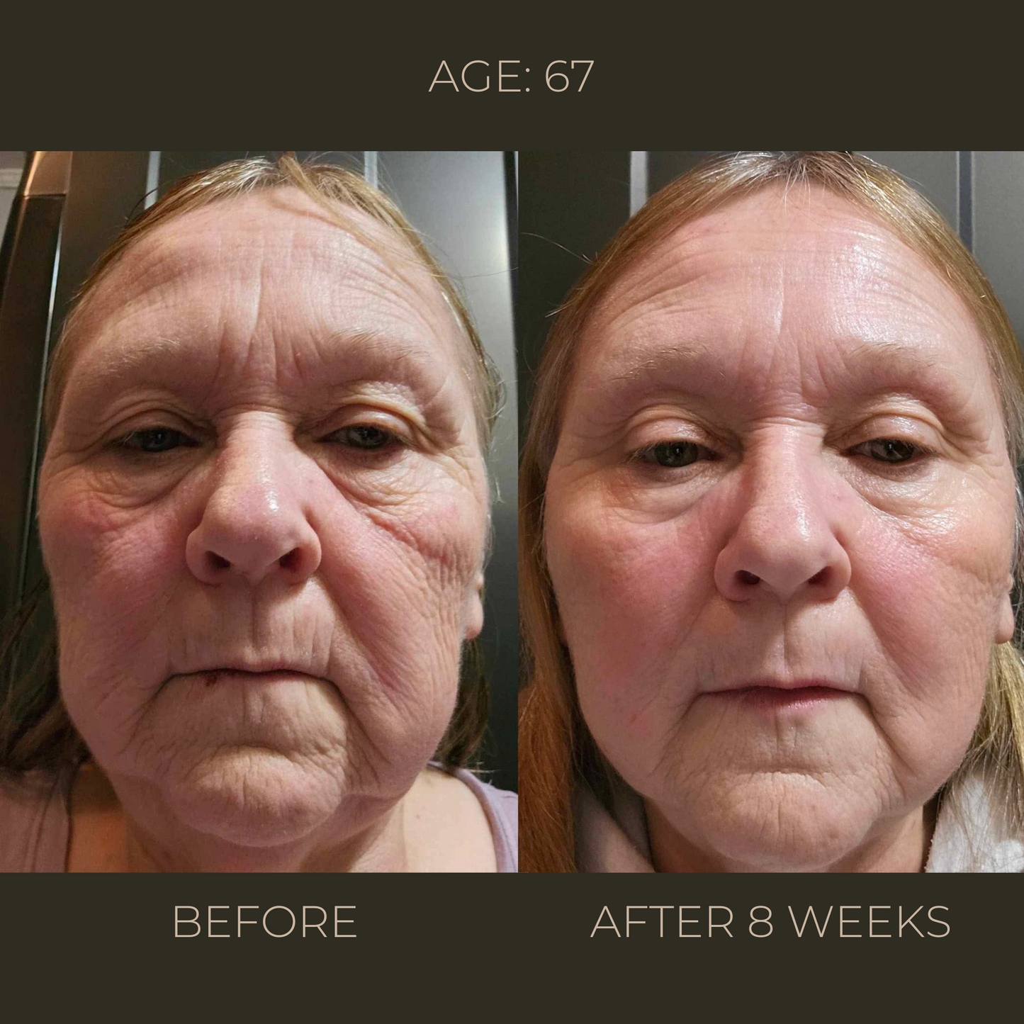 Eternal Youth | Advanced Rejuvenation Concentrate