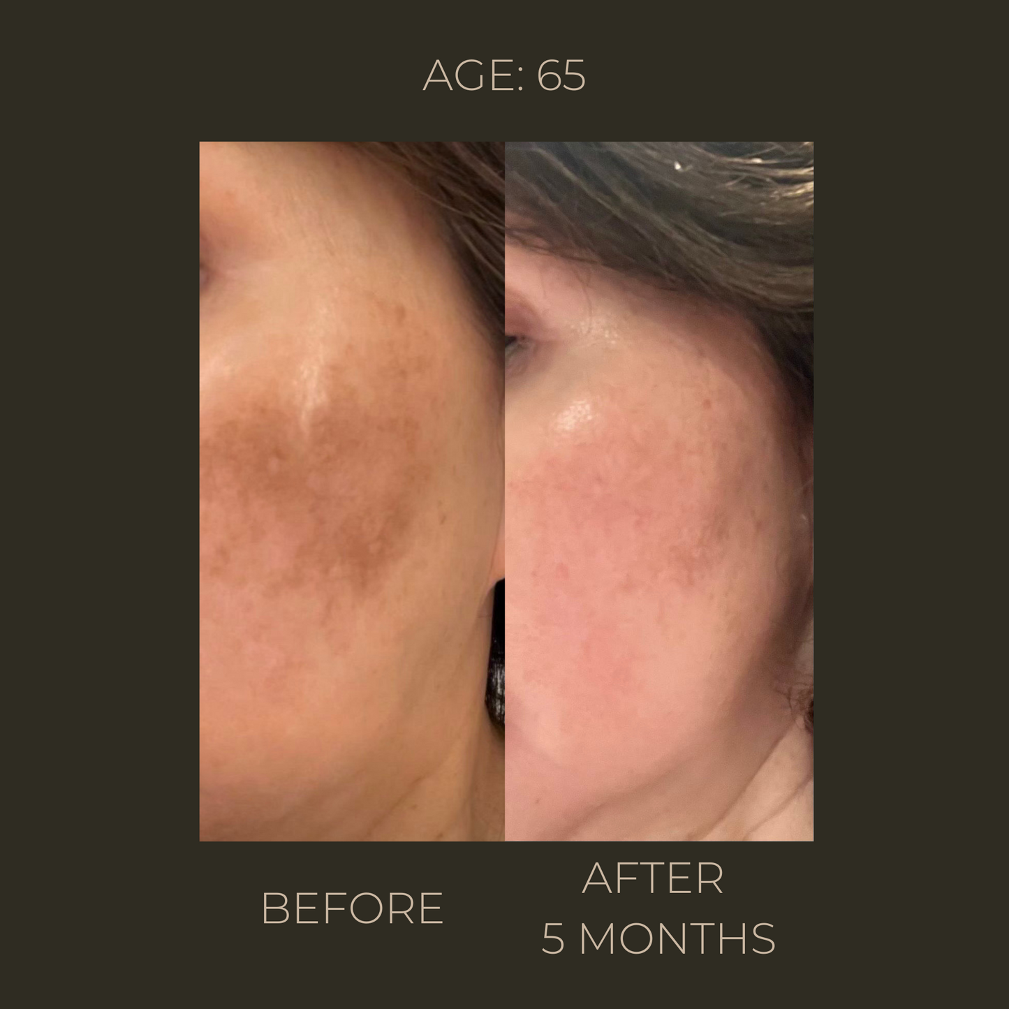 Eternal Youth | Advanced Rejuvenation Concentrate