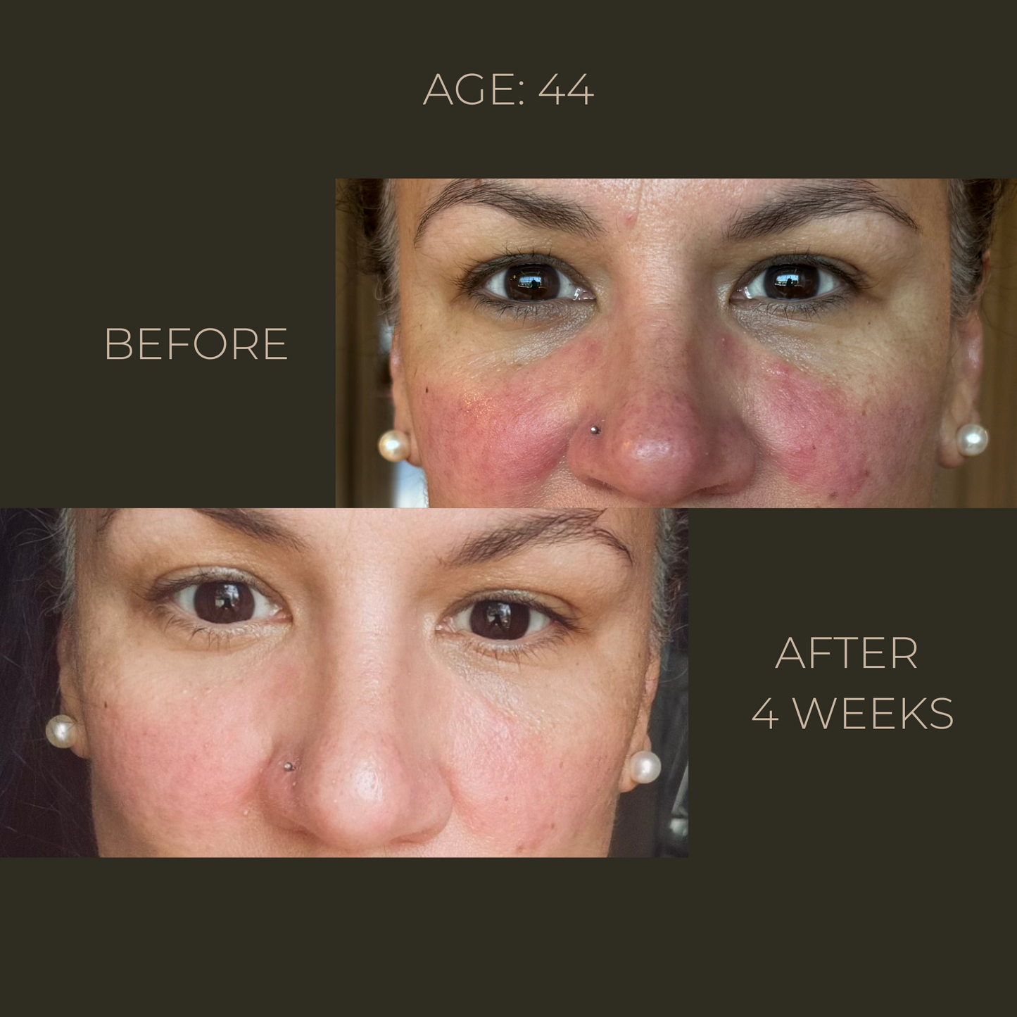 Eternal Youth | Advanced Rejuvenation Concentrate